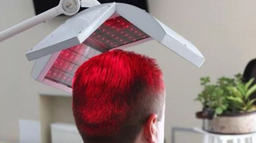 Saç Lazeri Nasıl Uygulanır?